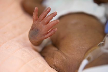 Preterm Birth Rates Rise in Low-Income Households