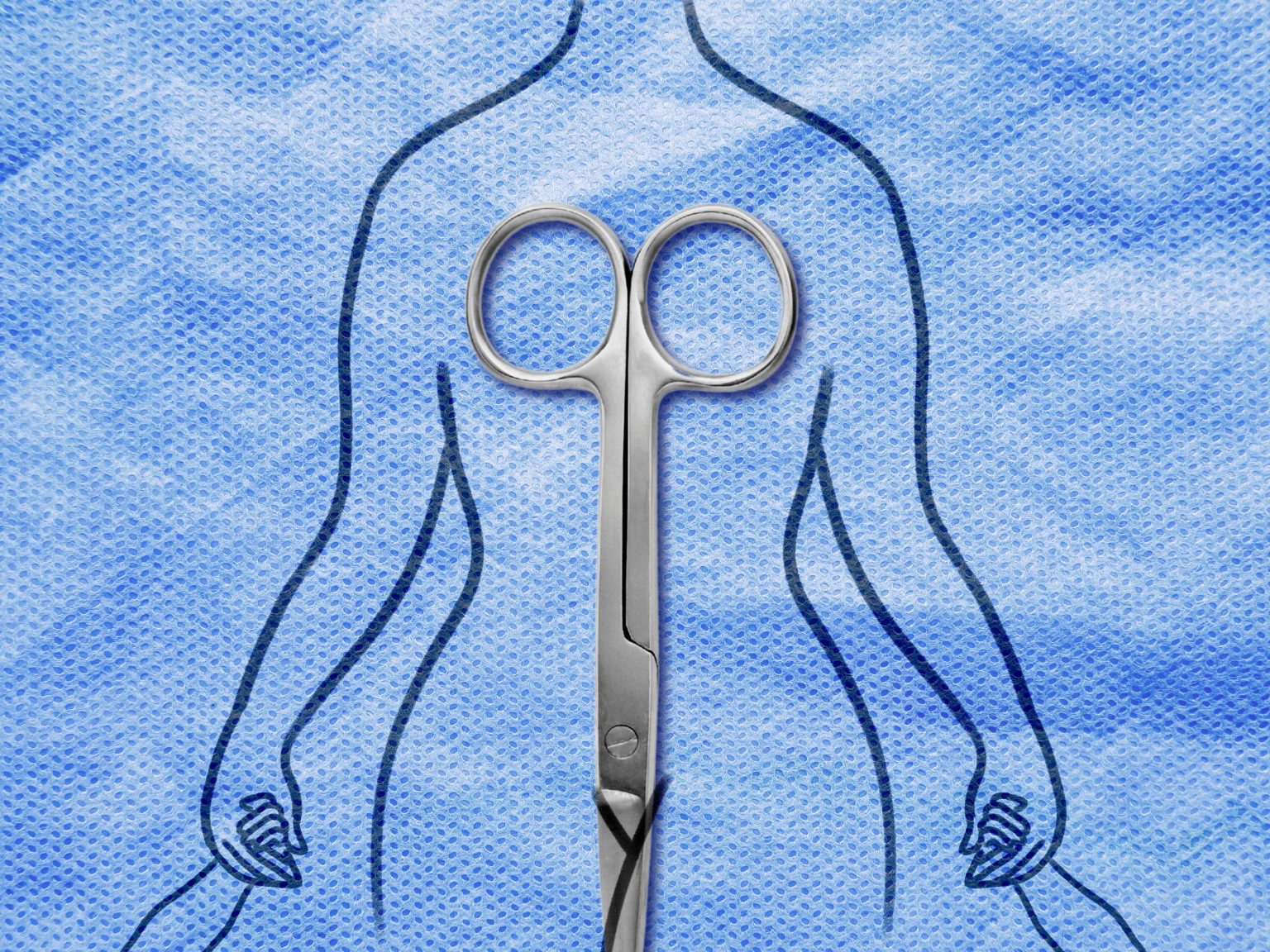 I’m a Psychiatrist Who Treats Body Image Issues. I Also Got a Mommy Makeover