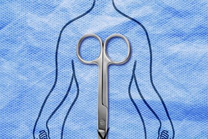 I’m a Psychiatrist Who Treats Body Image Issues. I Also Got a Mommy Makeover