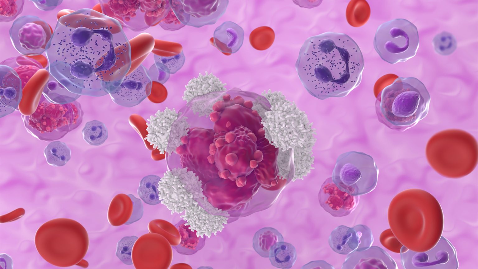 CAR7 Gene Therapy Shows Promise in T-Cell ALL