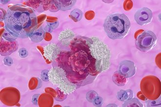 CAR7 Gene Therapy Shows Promise in T-Cell ALL