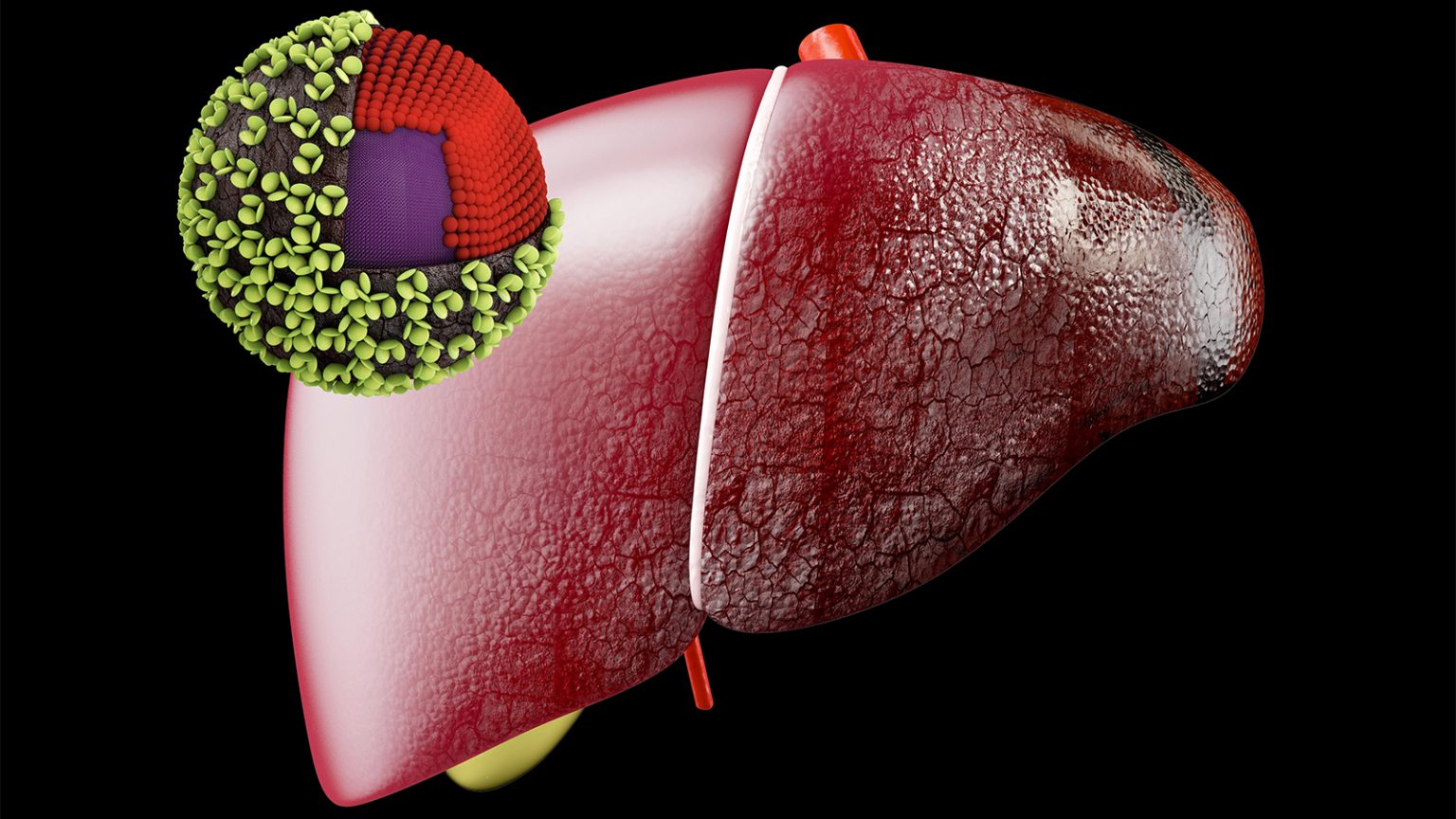 ‘They’ve Just Gotten It Wrong’: Vaccine Shift Raises Fears of Hepatitis A, B Surges