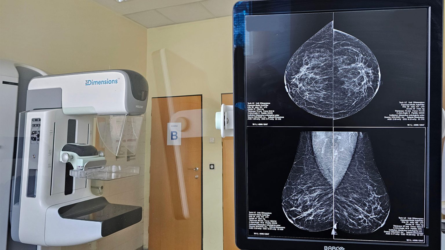 Trump Bill May Result in Over a Million Missed Cancer Screenings