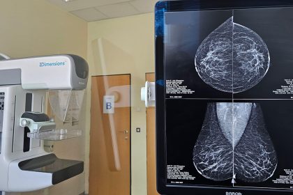 Trump Bill May Result in Over a Million Missed Cancer Screenings