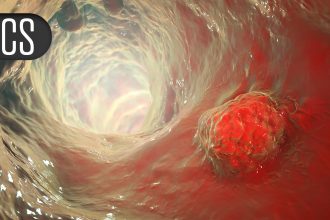 CAR-Like T Cells Enhance Tumor Response in Gastroesophageal Cancer