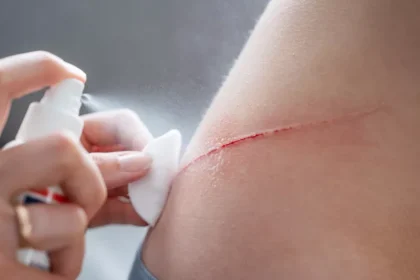 Scientists create a spray-on powder that seals life-threatening wounds in seconds