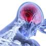 Study finds early withdrawal of care may limit recovery in severe brain injury