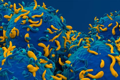 Autoimmune Anemia Is the Latest Condition Found Responsive to CAR-T Therapy