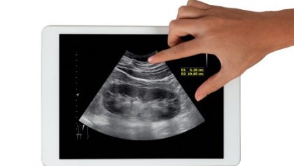 Understanding kidney health: What South Africans need to know